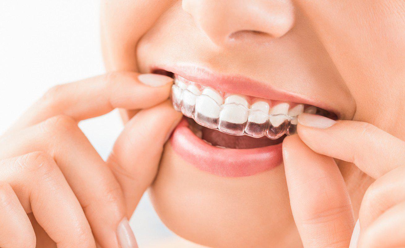 Modern teeth